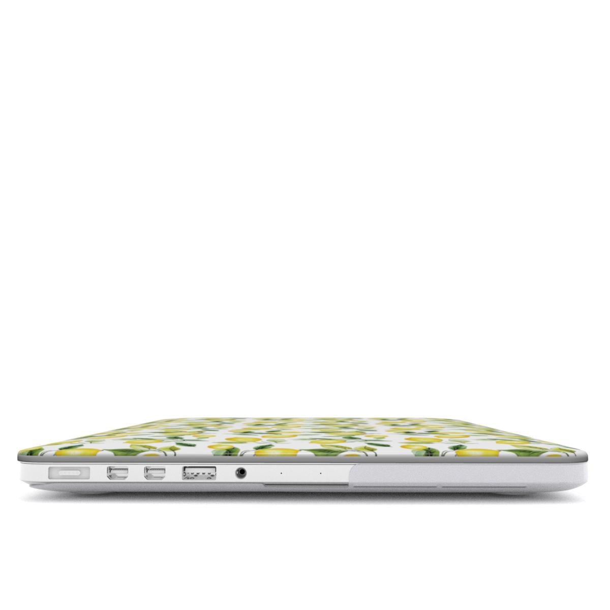 Case and Charm Lemon Lush | Protective MacBook Case - Tech Accessories