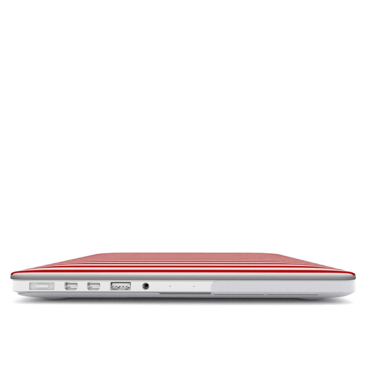 Berry Pop | MacBook Case - Tech Accessories