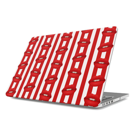 Berry Smooch | MacBook Case - Tech Accessories