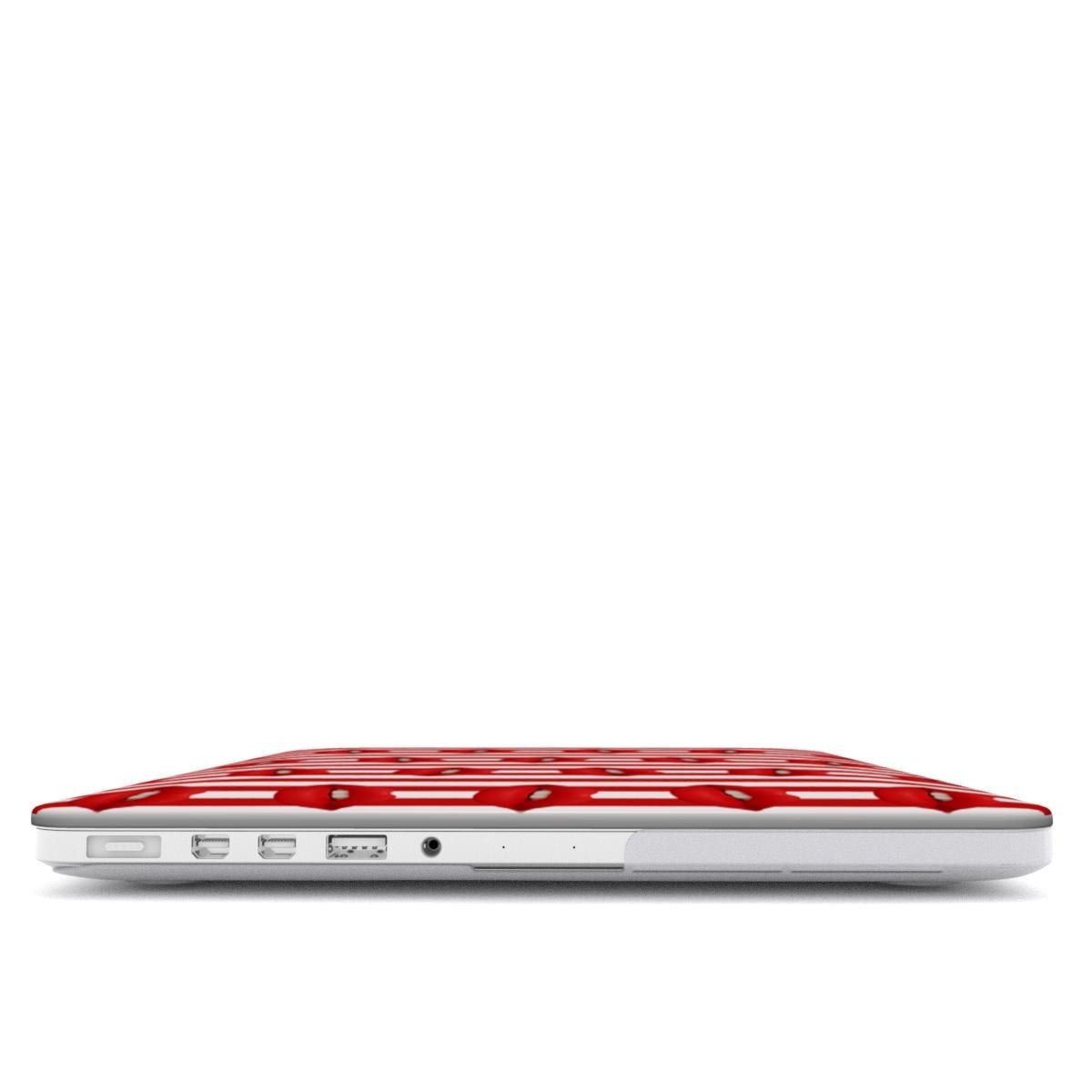 Berry Smooch | MacBook Case - Tech Accessories