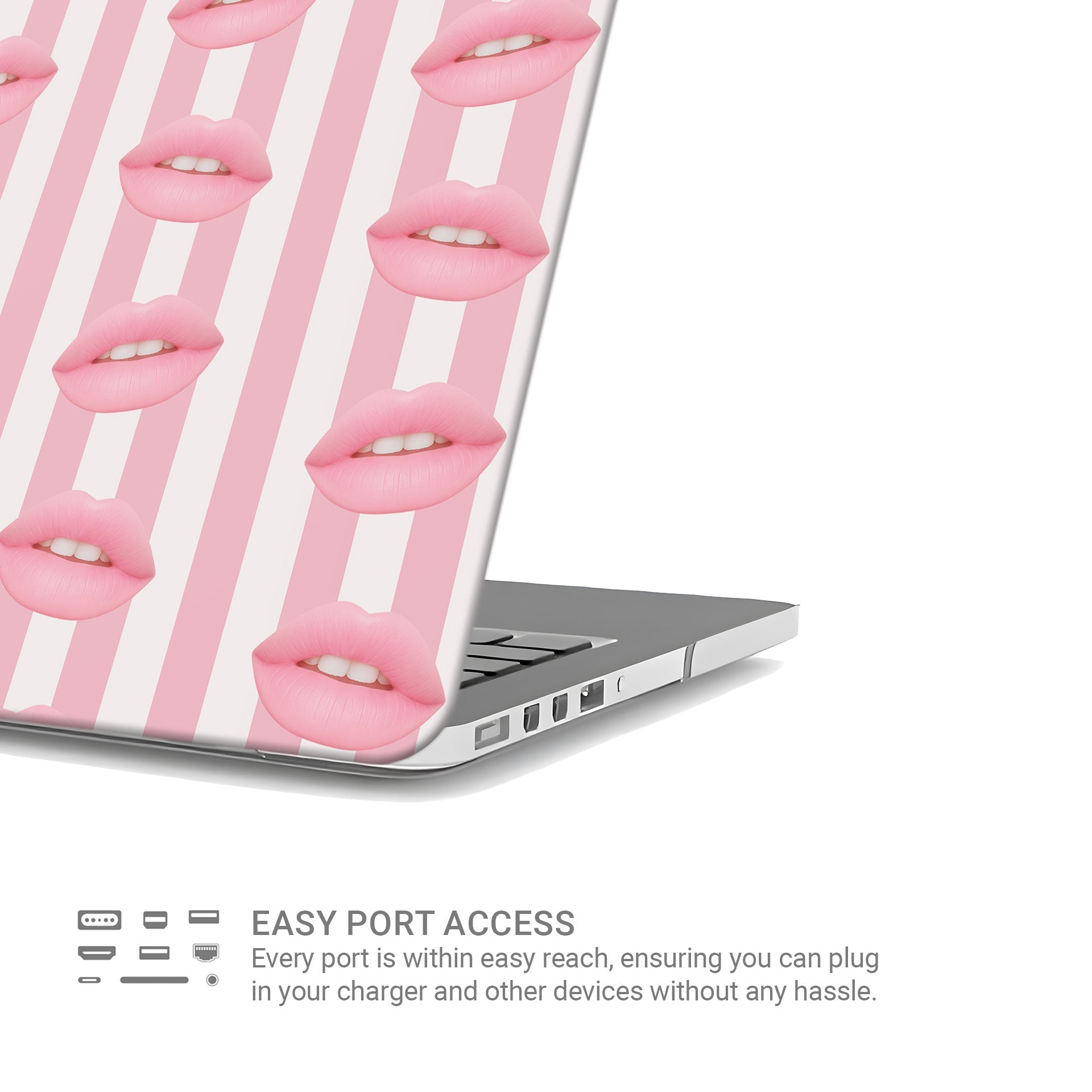 Candy Kiss | MacBook Case - Tech Accessories