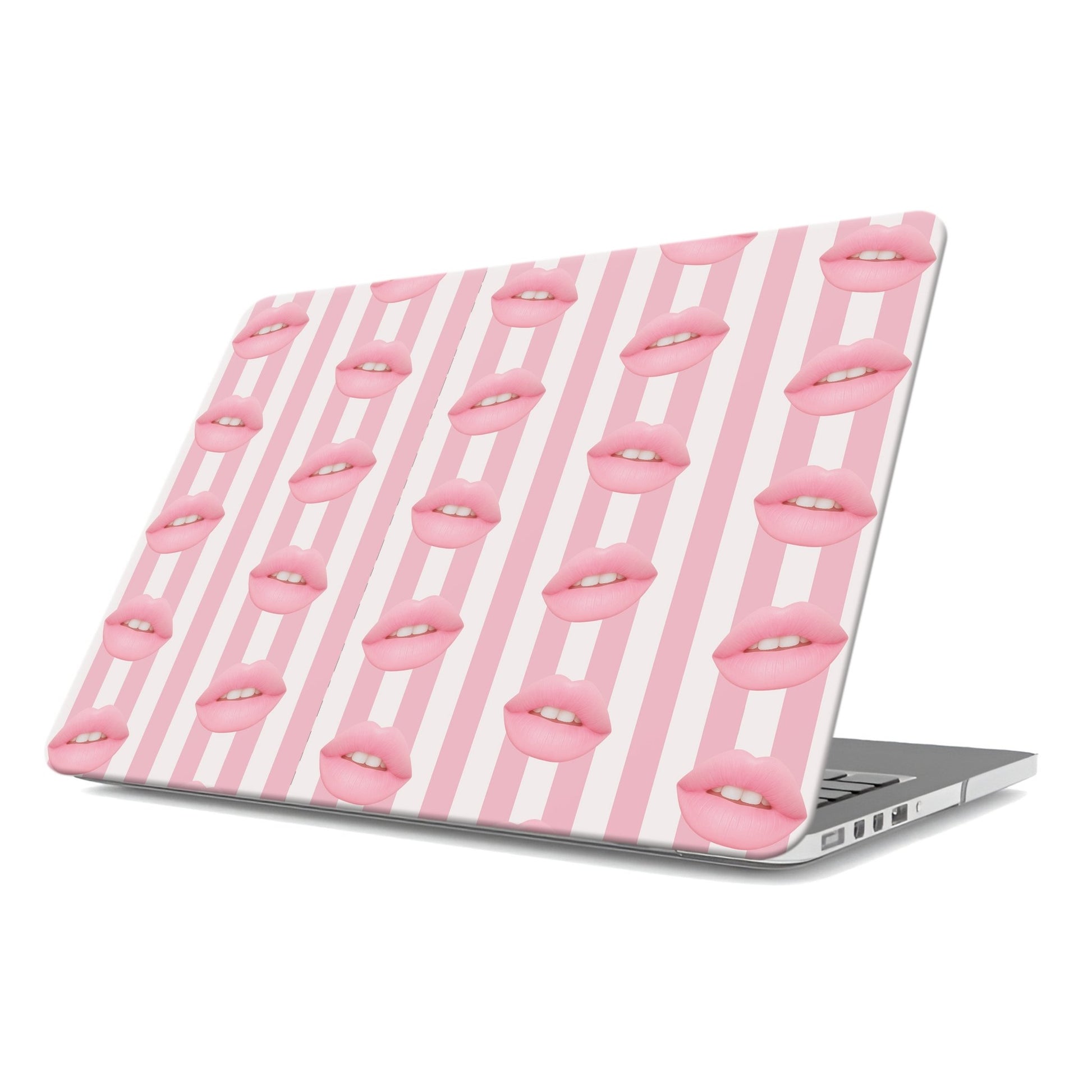 Candy Kiss | MacBook Case - Tech Accessories