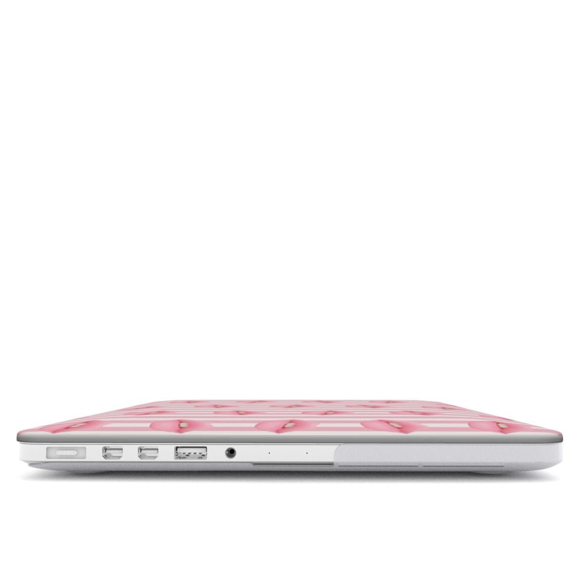 Candy Kiss | MacBook Case - Case & Charm