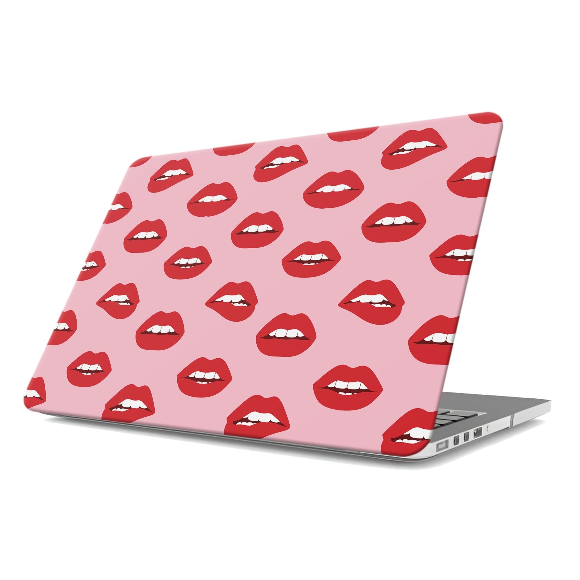 Cherry Sundae | MacBook Case - Tech Accessories