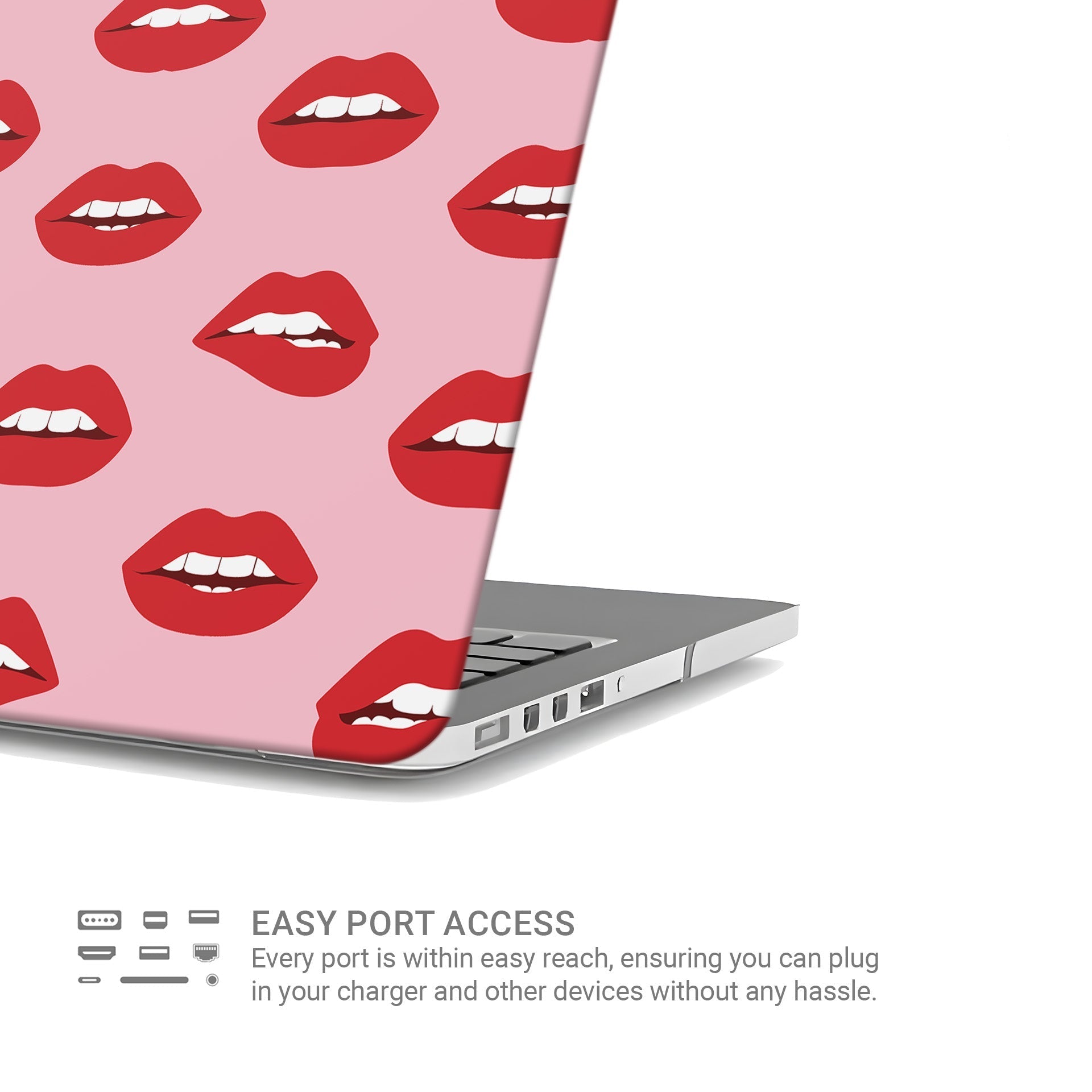 Cherry Sundae | MacBook Case - Tech Accessories