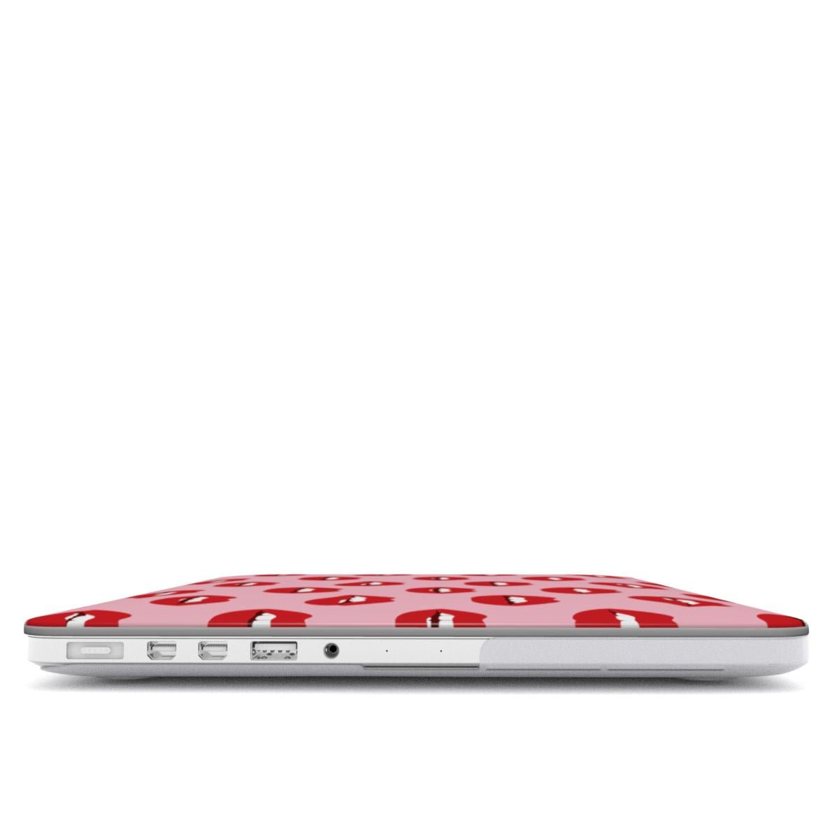 Cherry Sundae | MacBook Case - Tech Accessories