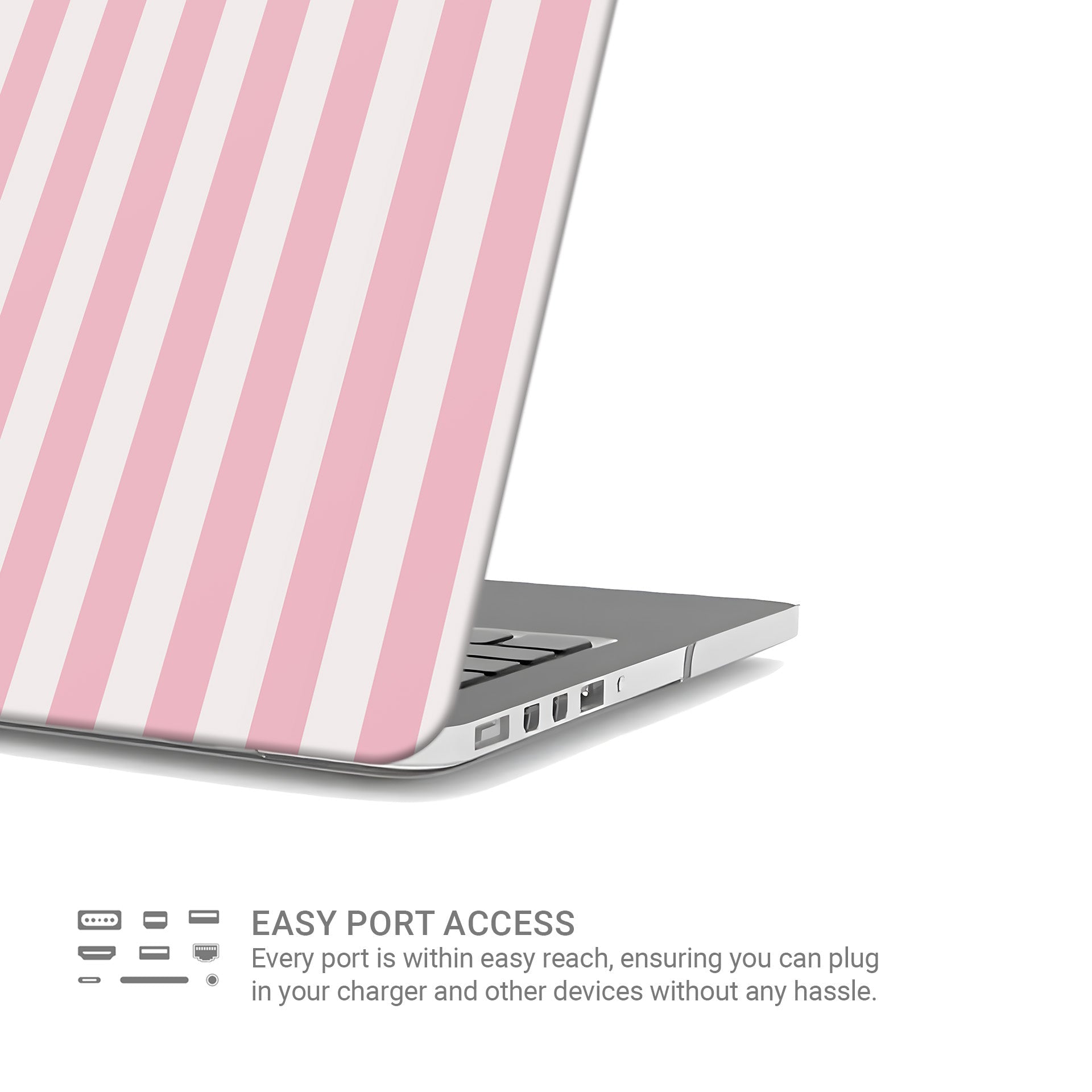 Cotton Candy | MacBook Case - Tech Accessories
