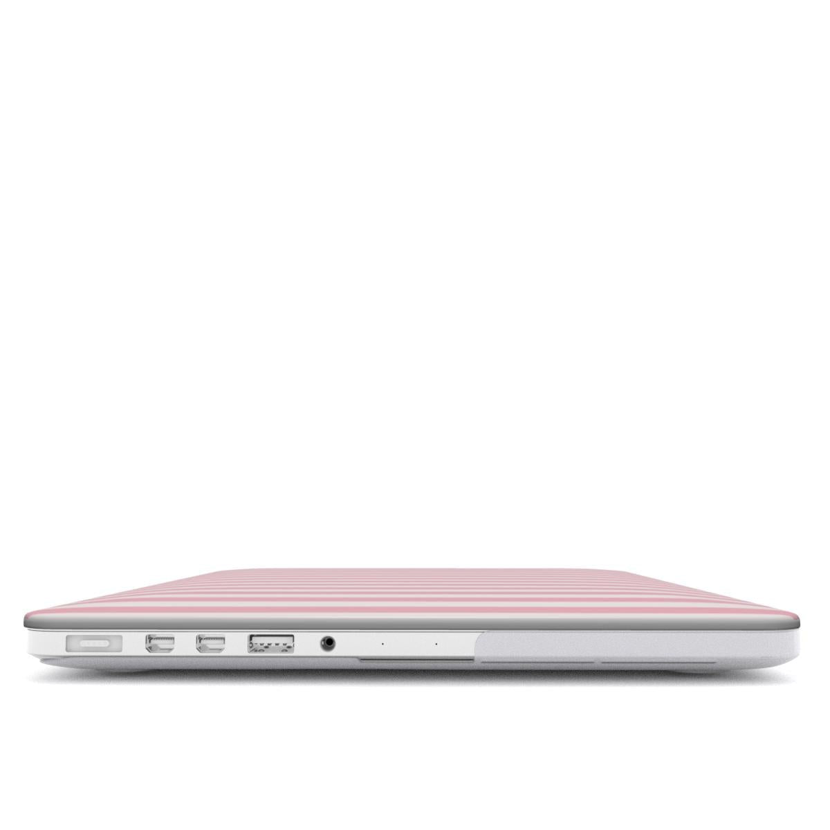 Cotton Candy | MacBook Case - Tech Accessories