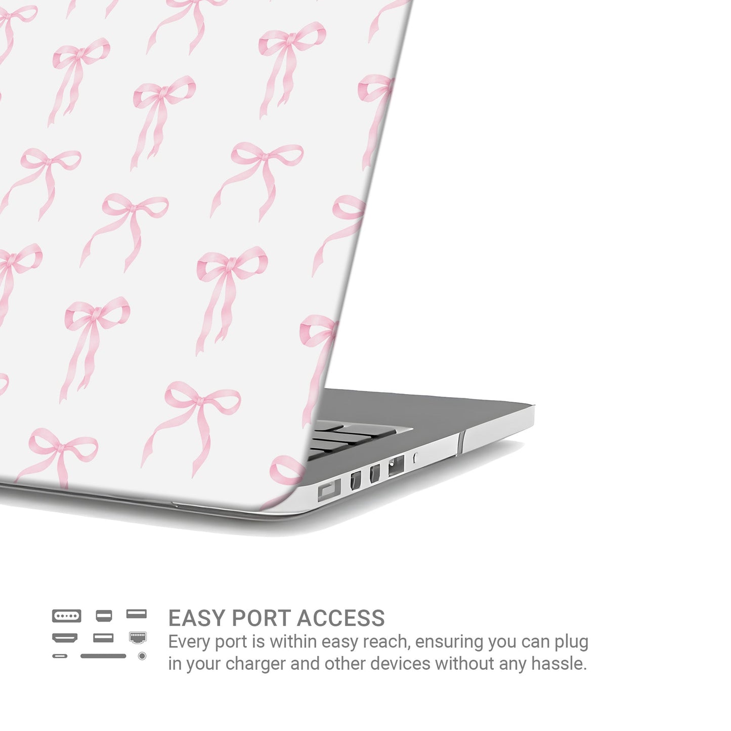 Pastel Confetti MacBook Case with pink ribbon bow design