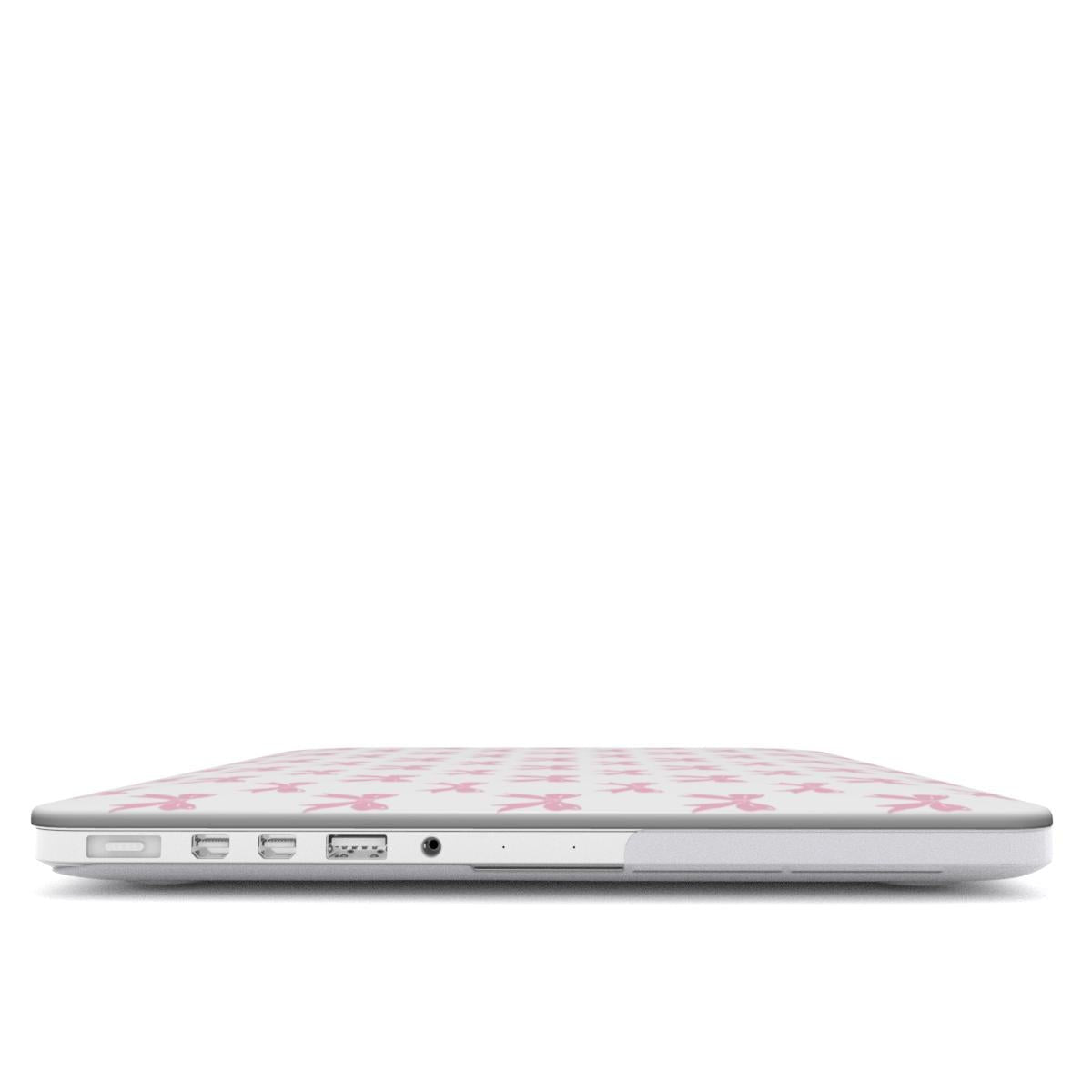 Pastel Confetti MacBook Case with pink ribbon bow design