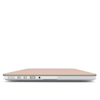 Pink and yellow striped MacBook case with vertical pastel candy stripe print on a slim hard shell Apple MacBook cover by Case & Charm.