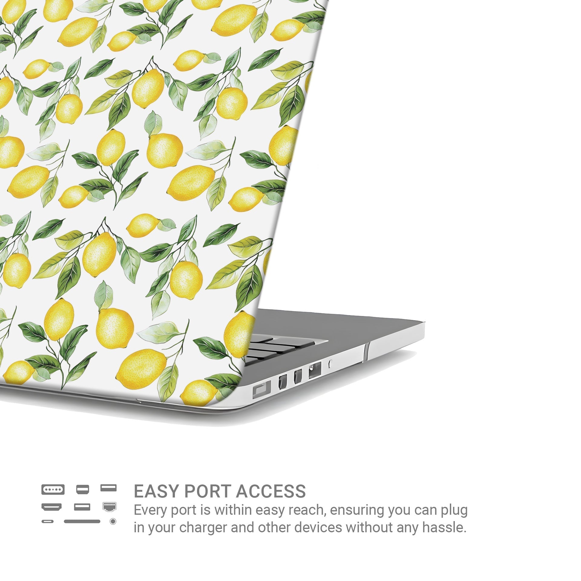 Case and Charm Lemon Lush | Protective MacBook Case - Tech Accessories