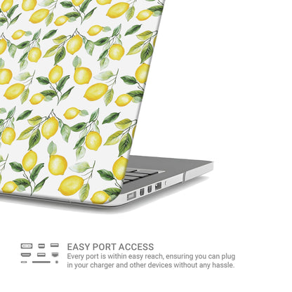 Case and Charm Lemon Lush | Protective MacBook Case - Tech Accessories