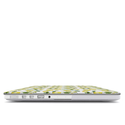 Case and Charm Lemon Lush | Protective MacBook Case - Tech Accessories