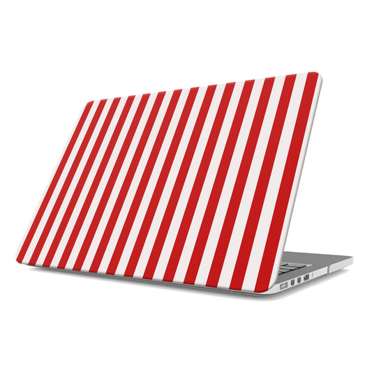 Berry Pop | MacBook Case - Tech Accessories