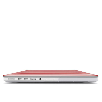 Berry Pop | MacBook Case - Tech Accessories