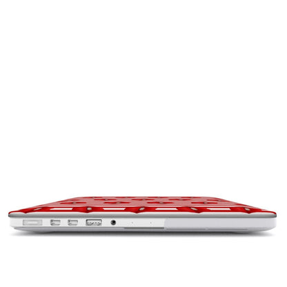 Berry Smooch | MacBook Case - Tech Accessories