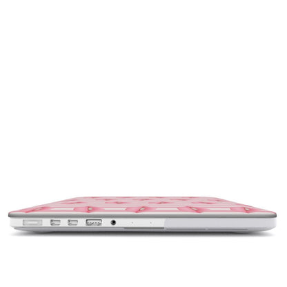 Candy Kiss | MacBook Case - Case & Charm