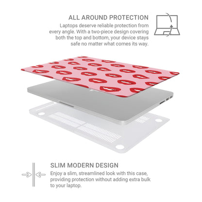 Cherry Sundae | MacBook Case - Tech Accessories