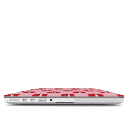 Cherry Sundae | MacBook Case - Tech Accessories