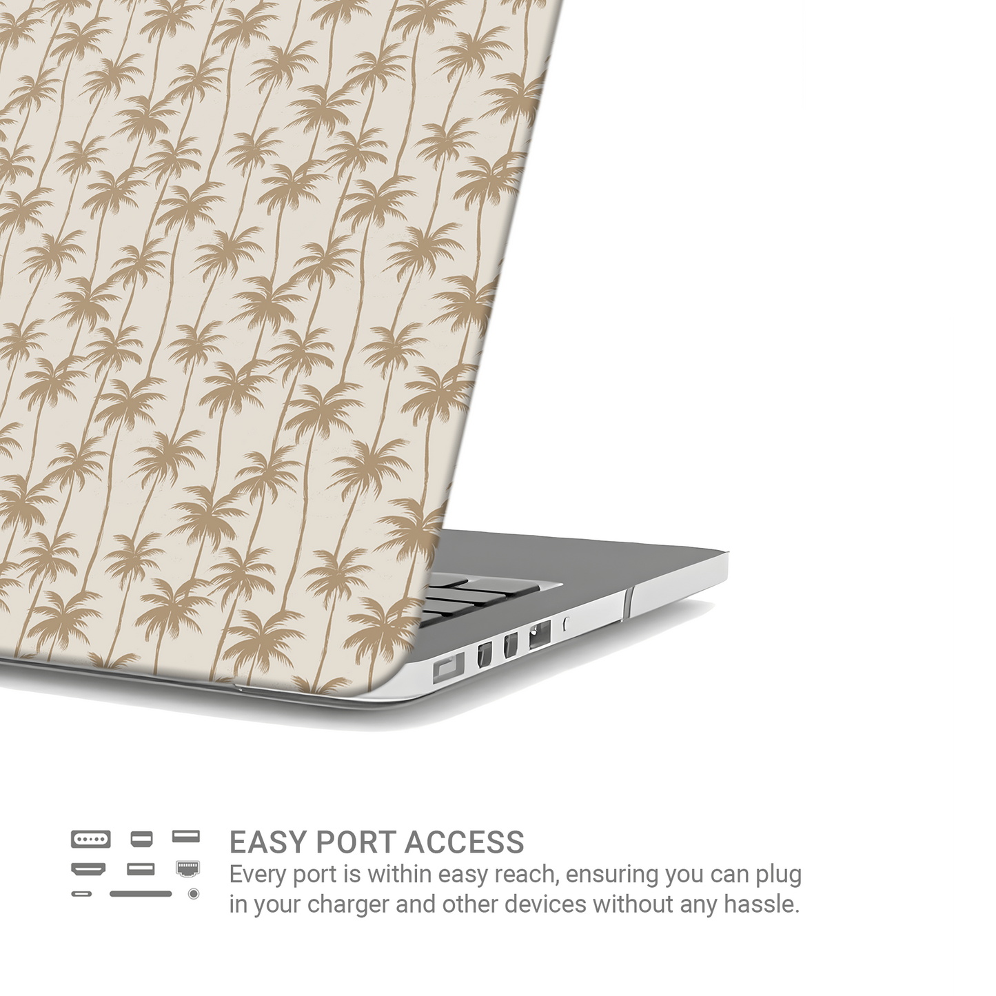 Coconut Daydream | MacBook Case - Case & Charm