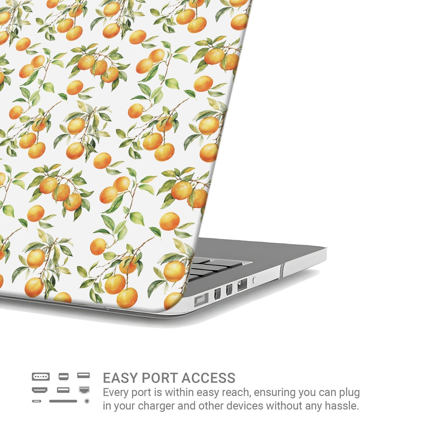 Golden Grove | MacBook Case - Tech Accessories