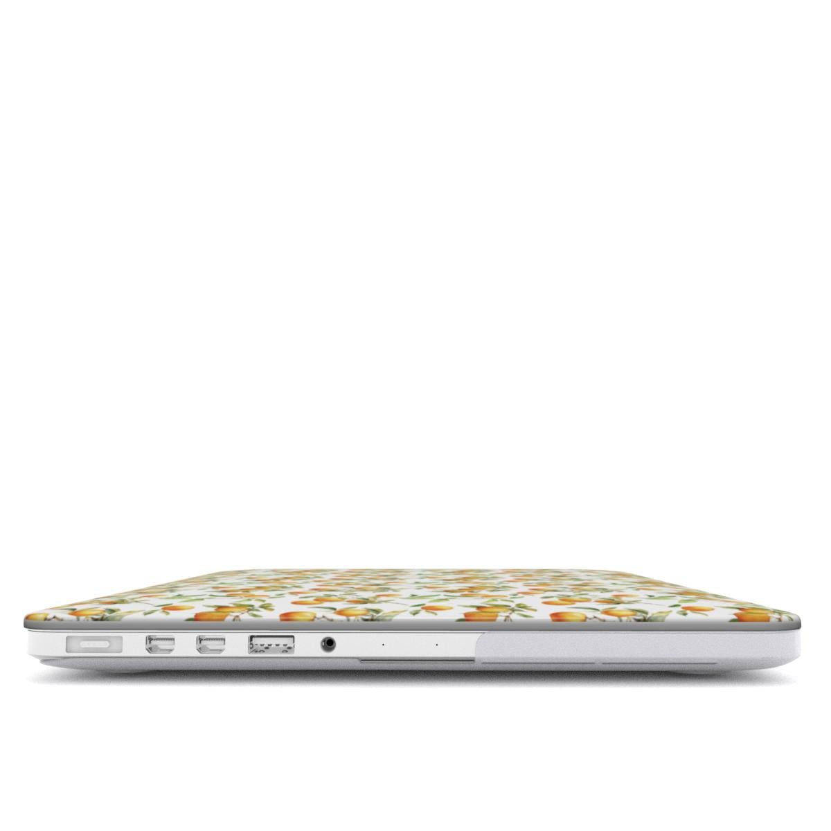 Golden Grove | MacBook Case - Tech Accessories