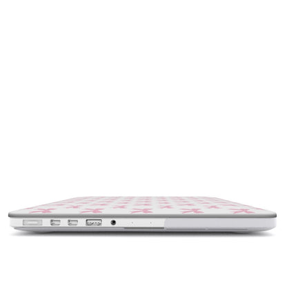 Pastel Confetti MacBook Case with pink ribbon bow design