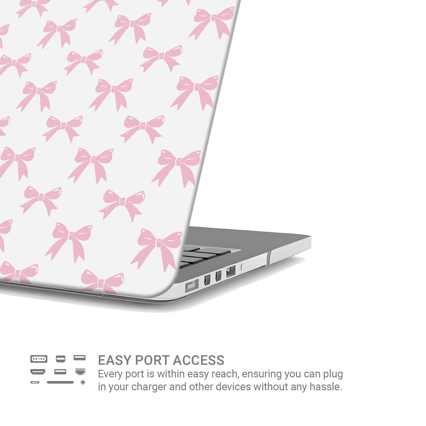 MacBook Case with pink ribbon bow design