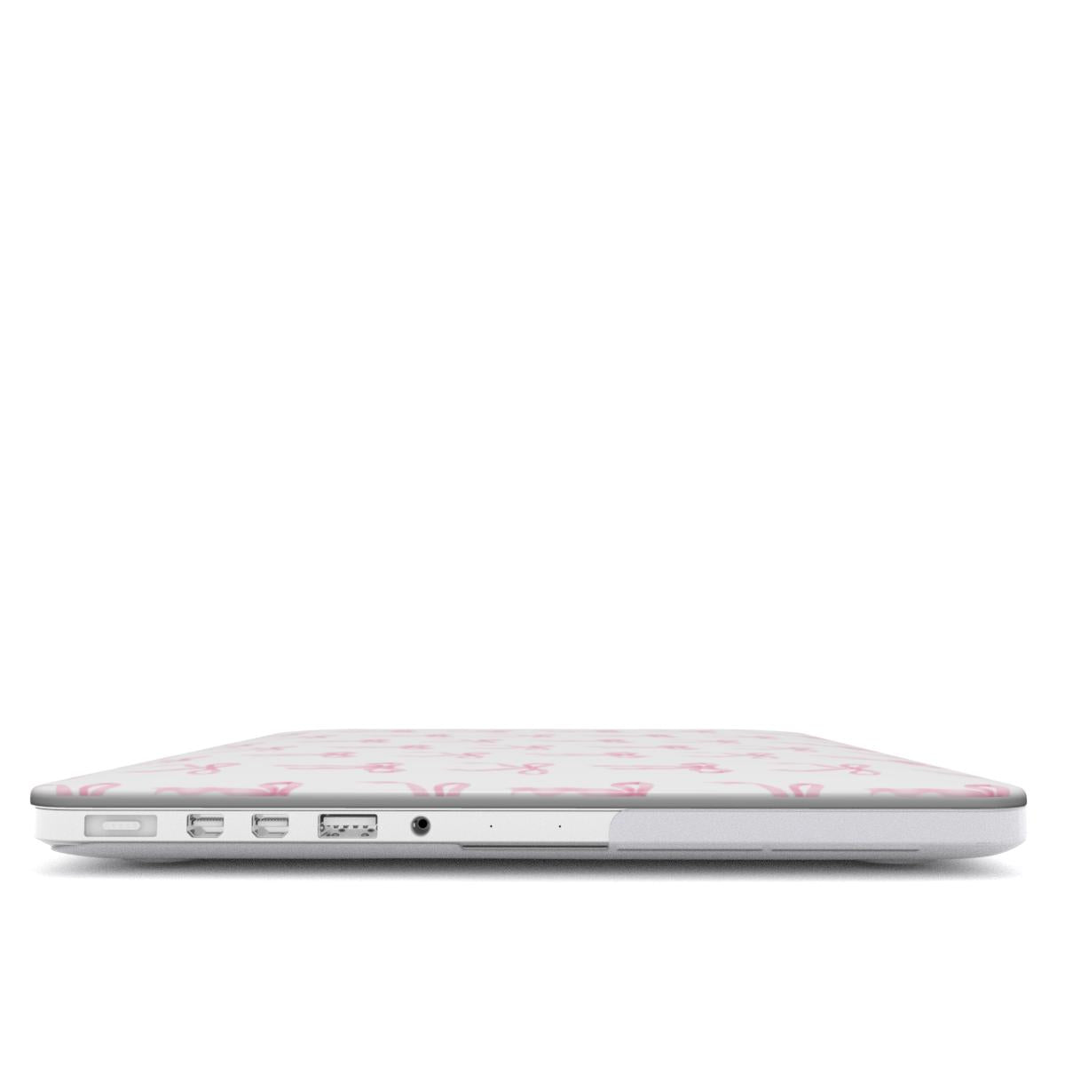 MacBook Case with pink ribbon bow design