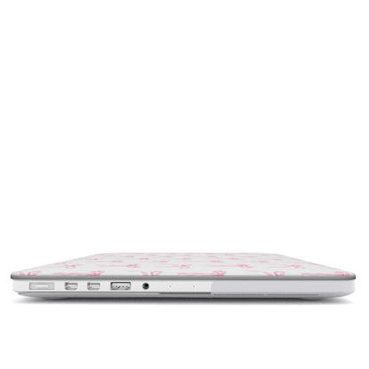 MacBook Case with pink ribbon bow design